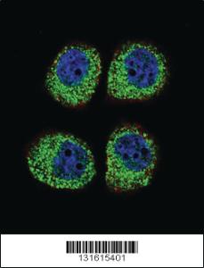 Anti-ARRB1 Rabbit Polyclonal Antibody