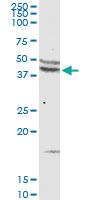 Anti-CCR5 Rabbit Polyclonal Antibody