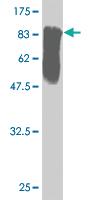 Anti-STK33 Mouse Monoclonal Antibody [clone: 4A12]