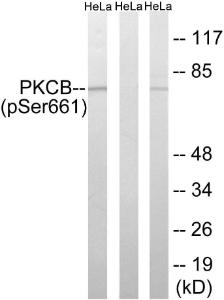 Western blot analysis of lysates from HeLa treated with PMA (left), HeLa (middle), and HeLa treated with heat shock (right) using Anti-PKCB (phospho Ser661) Antibody