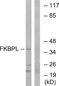 Western blot analysis of lysates from Jurkat cells using Anti-FKBPL Antibody. The right hand lane represents a negative control, where the antibody is blocked by the immunising peptide.