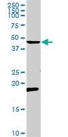 Anti-CCR5 Rabbit Polyclonal Antibody