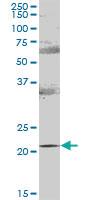 Anti-RAB31 Mouse Polyclonal Antibody