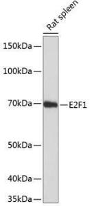 Western blot analysis of extracts of rat spleen, using Anti-E2F1 Antibody [ARC0058] (A308217) at 1:1000 dilution