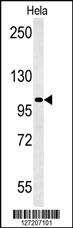 Anti-RGS22 Rabbit Polyclonal Antibody