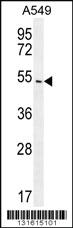 Anti-ARRB1 Rabbit Polyclonal Antibody