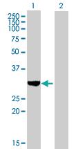 Anti-SULT1C2 Mouse Polyclonal Antibody