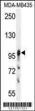 Anti-AXIN1 Rabbit Polyclonal Antibody (AP (Alkaline Phosphatase))