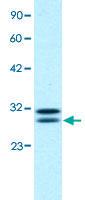 Anti-HTATIP2 Rabbit Polyclonal Antibody