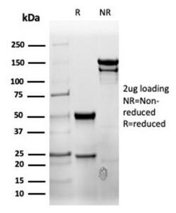 SDS-PAGE analysis of Anti-CD7 Antibody [rCD7/6387] under non-reduced and reduced conditions; showing intact IgG and intact heavy and light chains, respectively. SDS-PAGE analysis confirms the integrity and purity of the antibody