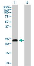 Anti-RAB31 Rabbit Polyclonal Antibody