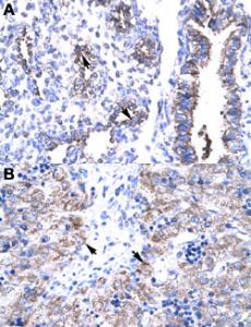 Anti-HTATIP2 Rabbit Polyclonal Antibody