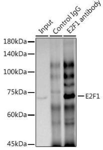 Immunoprecipitation analysis of 300 µg extracts of HT-29 cells using 3 µg of Anti-E2F1 Antibody [ARC0058] (A308217). This Western blot was performed on the immunoprecipitate using Anti-E2F1 Antibody [ARC0058] (A308217) at a dilution of 1:1000