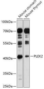 Western blot analysis of extracts of various cell lines, using Anti-PLEK2 Antibody (A307199) at 1:1,000 dilution. The secondary antibody was Goat Anti-Rabbit IgG H&L Antibody (HRP) at 1:10,000 dilution.