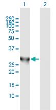 Anti-PNMT Rabbit Polyclonal Antibody