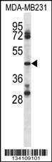 Anti-CD84 Rabbit Polyclonal Antibody (APC (Allophycocyanin))