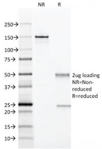 SDS-PAGE analysis of Anti-CD28 Antibody [204.12] under non-reduced and reduced conditions; showing intact IgG and intact heavy and light chains, respectively. SDS-PAGE analysis confirms the integrity and purity of the antibody