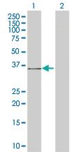 Anti-ACKR2 Mouse Polyclonal Antibody