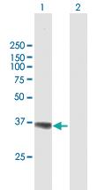 Anti-AKR1A1 Mouse Polyclonal Antibody