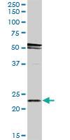 Anti-RAB31 Rabbit Polyclonal Antibody