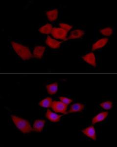 Antibody anti-SIRT2 100 µl