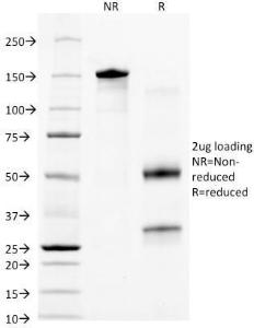 SDS-PAGE analysis of Anti-Cytokeratin 18 Antibody [KRT18/836] under non-reduced and reduced conditions; showing intact IgG and intact heavy and light chains, respectively. SDS-PAGE analysis confirms the integrity and purity of the Antibody