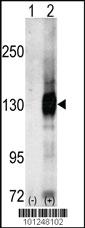 Anti-CASK Rabbit Polyclonal Antibody