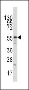 Anti-HIV-1 Tat Interacting Protein, 60kD Rabbit Polyclonal Antibody (FITC (Fluorescein))