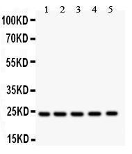 Anti-Hsp27 Polyclonal Antibody