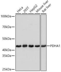 Western blot analysis of extracts of various cell lines, using Anti-PDHA1 Antibody [ARC0722] (A308220) at 1:1000 dilution