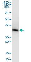 Anti-PNMT Rabbit Polyclonal Antibody