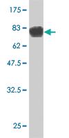 Anti-STK33 Mouse Monoclonal Antibody [clone: 4F7]