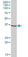 Anti-AKR1A1 Mouse Polyclonal Antibody