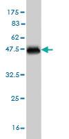 Anti-SRPK1 Mouse Monoclonal Antibody [clone: 2E8]