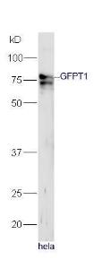 Anti-GFPT1 Rabbit Polyclonal Antibody