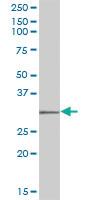 Anti-SULT1C2 Mouse Polyclonal Antibody