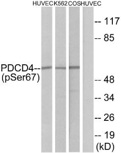 Western blot analysis of lysates from HUVEC cells, K562 cells and COS-7 cells using Anti-PDCD4 (phospho Ser67) Antibody. The right hand lane represents a negative control, where the Antibody is blocked by the immunising peptide