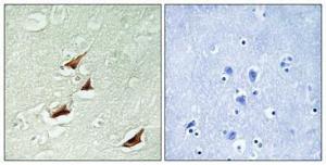 Immunohistochemical analysis of paraffin-embedded human brain using Anti-PDCD4 (phospho Ser67) Antibody 1:100 (4 °C overnight). The right hand panel represents a negative control, where the Antibody was pre-incubated with the immunising peptide