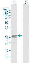 Anti-HEATR9 Mouse Polyclonal Antibody