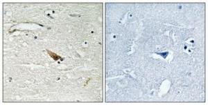 Immunohistochemical analysis of paraffin-embedded human brain using Anti-PDCD4 (phospho Ser67) Antibody 1:100 (4 °C overnight). The right hand panel represents a negative control, where the Antibody was pre-incubated with the immunising peptide