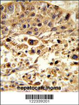 Anti-VPS26A Rabbit Polyclonal Antibody