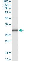 Anti-PNMT Mouse Monoclonal Antibody [clone: 3G4]