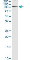 Anti-ELF1 Polyclonal Antibody Pair