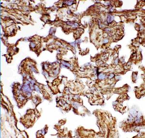 Anti-Hsp27 Polyclonal Antibody