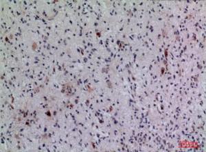 Immunohistochemical analysis of paraffin-embedded human brain using Anti-FGF5 Antibody