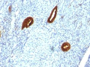 Anti-Cytokeratin 19 antibody