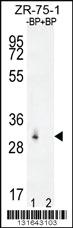 Anti-RAB40AL Rabbit Polyclonal Antibody