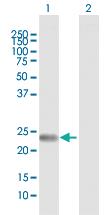 Anti-FNDC4 Rabbit Polyclonal Antibody