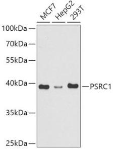 Western blot analysis of extracts of various cell lines, using Anti-PSRC1 / DDA3 Antibody (A307201) at 1:1,000 dilution. The secondary antibody was Goat Anti-Rabbit IgG H&L Antibody (HRP) at 1:10,000 dilution.