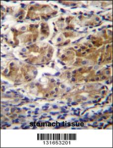 Anti-PDPR Rabbit Polyclonal Antibody